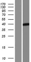 Human RPUSD4 Protein (Over-Expression Lysate Myc-DDK (Flag))