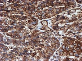 SCFD1 / SLY1 Antibody (clone OTI2E7)