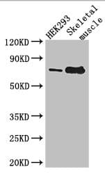 TDRD3 Antibody