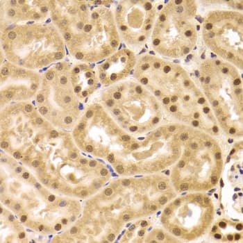 PHAP1 / ANP32A Antibody