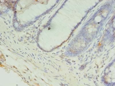 CCDC57 Antibody (Coiled-coil domain)
