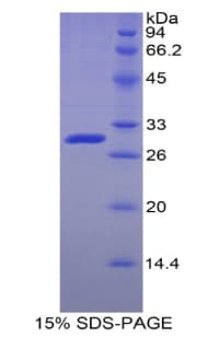 Human ADK / Adenosine Kinase Protein (Recombinant His)
