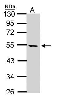 Polyclonal Rabbit anti-Human STK25 Antibody (aa1-231, IHC, WB)