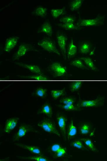 CD46 Antibody