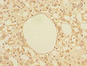 TRIAP1 Antibody