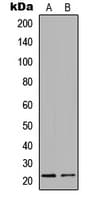 PathPlus™ Polyclonal Rabbit anti-Human CLDN3 / Claudin 3 Antibody (C-Terminus, IHC, IF, WB)