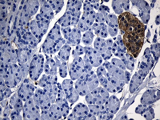 Monoclonal Mouse anti-Human GTPCH1 / GCH1 Antibody (clone OTI1A3, IHC, WB)