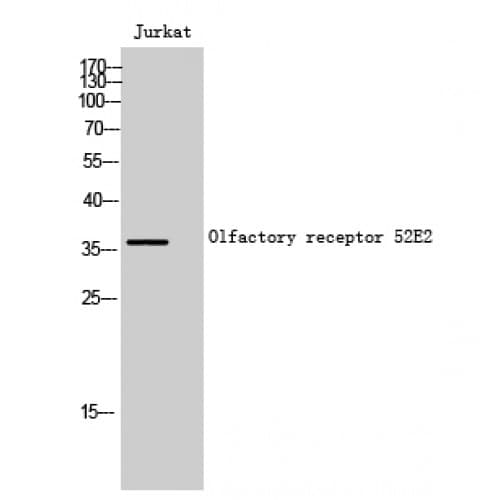 Polyclonal Rabbit anti-Human OR52E2 Antibody (250-330 aa, C-terminal, IF, WB)