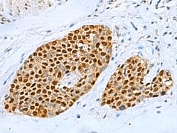 Polyclonal Rabbit anti-Human TFAP4 / AP-4 Antibody (IHC)