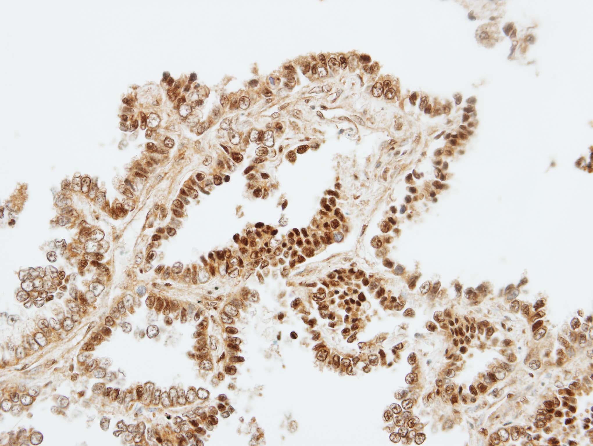 ZKSCAN3 / ZNF306 Antibody (aa1-394)