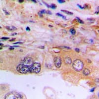 EEF2K Antibody (Internal)