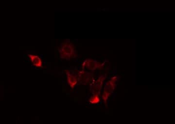 CCAR2 / KIAA1967 Antibody