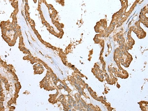 Polyclonal Rabbit anti-Human ALKBH8 Antibody (IHC, WB)