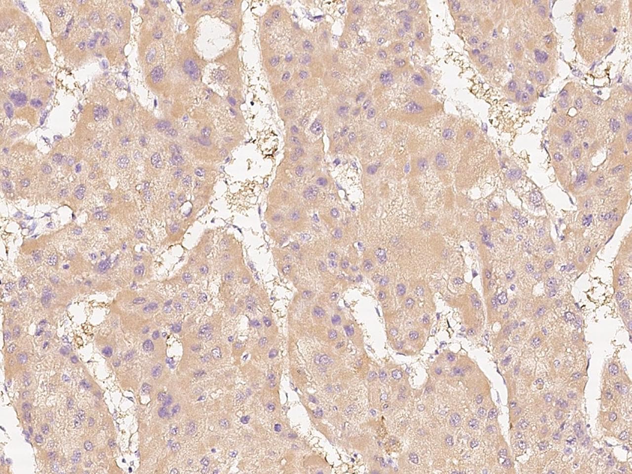 DDAH1 Antibody (Preservative Free)
