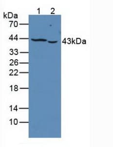PTPRJ / CD148 Antibody (aa1061-1293)