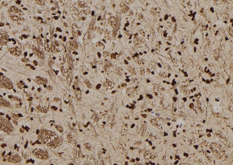 SERPINB3 Antibody