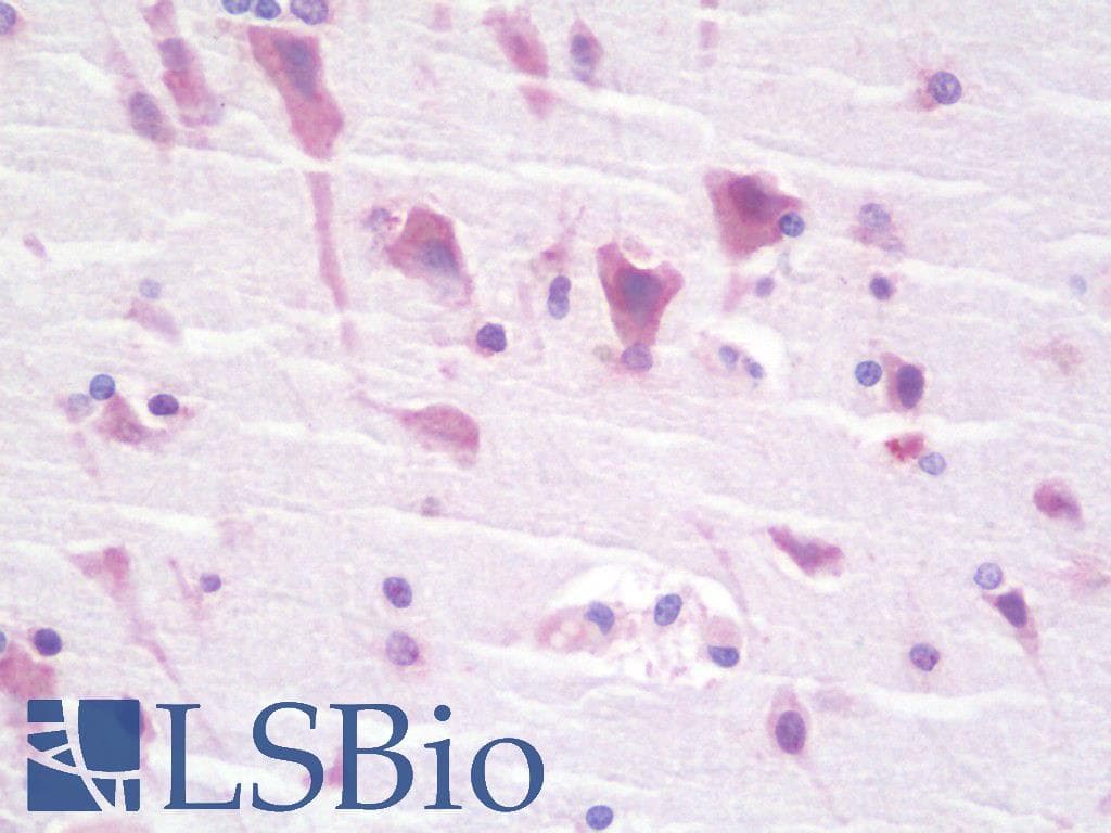 IHC-plus™ ABHD12 Antibody (aa231-280)