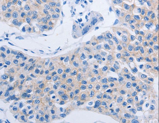 HOXA6 Antibody