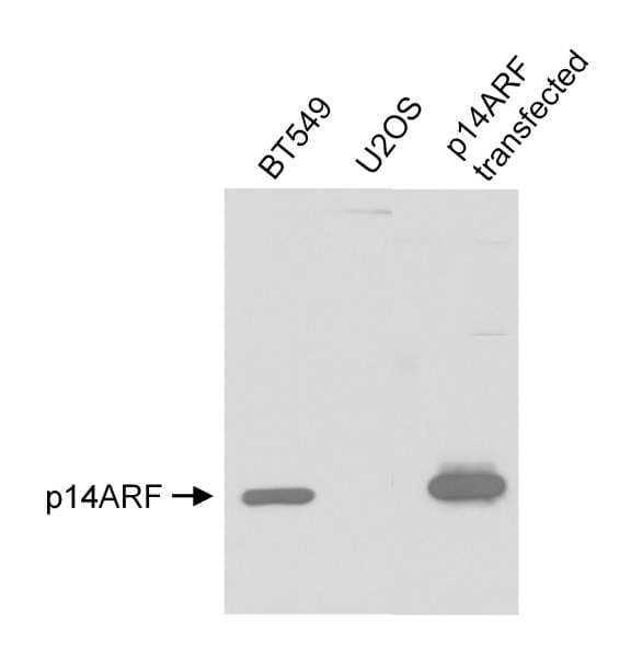 Polyclonal Rabbit anti-Human p14ARF / CDKN2A Antibody (aa125-C-term, IHC, WB)