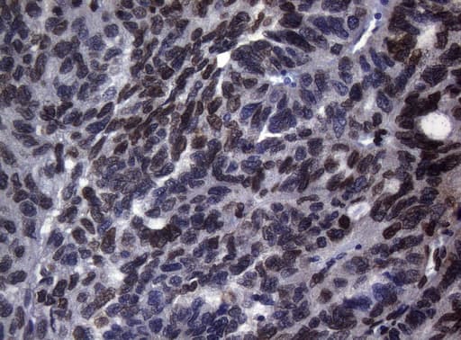 BCL6 Antibody (aa1-300, clone OTI1C3, Carrier-free)
