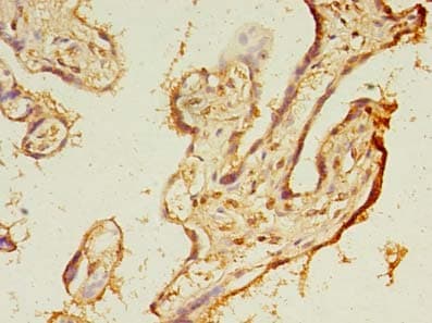 TMEM165 Antibody