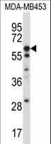 IHC-plus™ UMOD / Uromodulin Antibody (aa352-380)