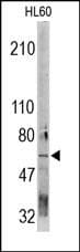 CDC73 / Parafibromin Antibody