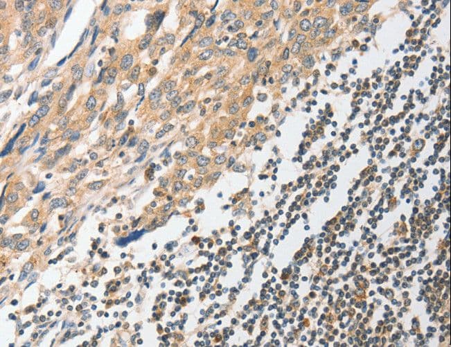 STAM1 / STAM Antibody