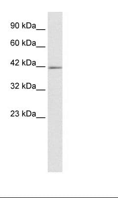 IKZF2 / HELIOS Antibody (aa396-445)