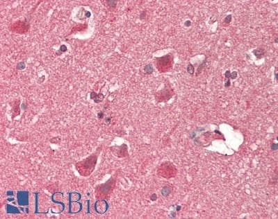 IHC-plus™ RHEB Antibody (clone 2C11)