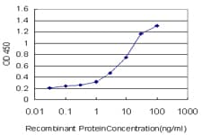 Monoclonal Mouse anti-Human PIBF1 / PIBF Antibody (clone 7B7, IHC, IF, WB)