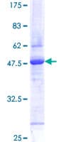 Human RMA1 / RNF5 Protein (Recombinant GST)