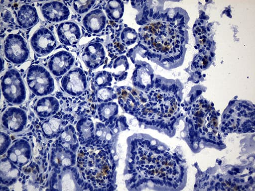 MSR1 / CD204 Antibody (aa197-451, clone UMAB246)
