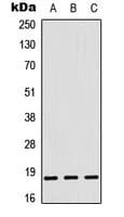 Polyclonal Rabbit anti-Human RPL12 / Ribosomal Protein L12 Antibody (Internal, IHC, WB)