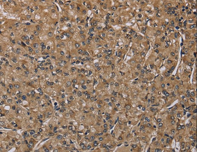 Polyclonal Rabbit anti-Human NALP4 / NLRP4 Antibody (IHC)