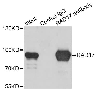 Polyclonal Rabbit anti-Human RAD17 Antibody (IHC, IF, WB)