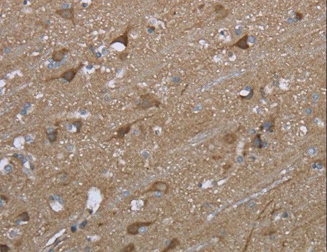 PTK2B / PYK2 Antibody