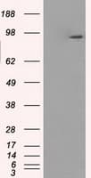 Monoclonal Mouse anti-Human GBE1 Antibody (clone OTI1D11, IHC, IF, WB)