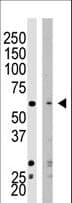 Polyclonal Rabbit anti-Human SETD8 / SET8 Antibody (aa25-53, IHC, WB)