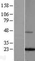 FTL / Ferritin Light Chain Protein (Over-Expression Lysate Myc-DDK (Flag))