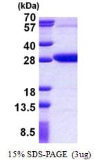 Human REXO2 Protein (Recombinant His)