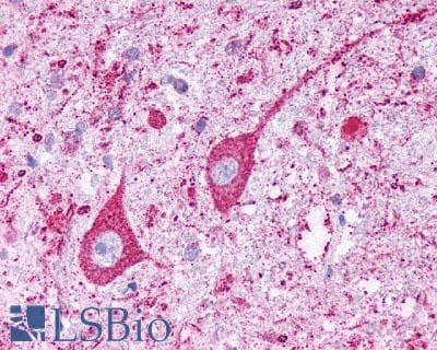 PathPlus™ KISS1R / GPR54 Antibody (N-Terminus)