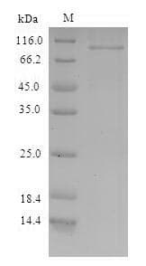 Paracoccus denitrificans Nitrous-oxide reductase Protein (Recombinant 6His-SUMO, N-terminus)