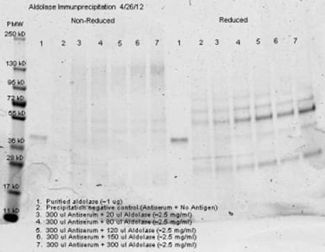 ALDOA / Aldolase A Antibody (Liquid)