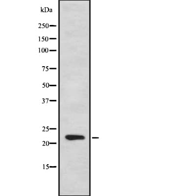 IFNA7 / Interferon Alpha 7 Antibody
