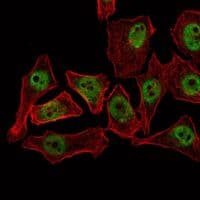 CTG-B45d / THAP11 Antibody (clone 3F3)