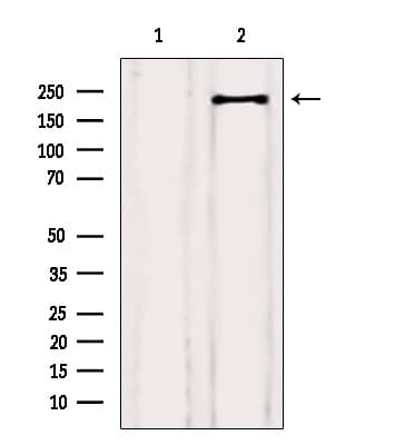 KDR / VEGFR2 / FLK1 Antibody