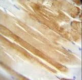 NCL / Nucleolin Antibody