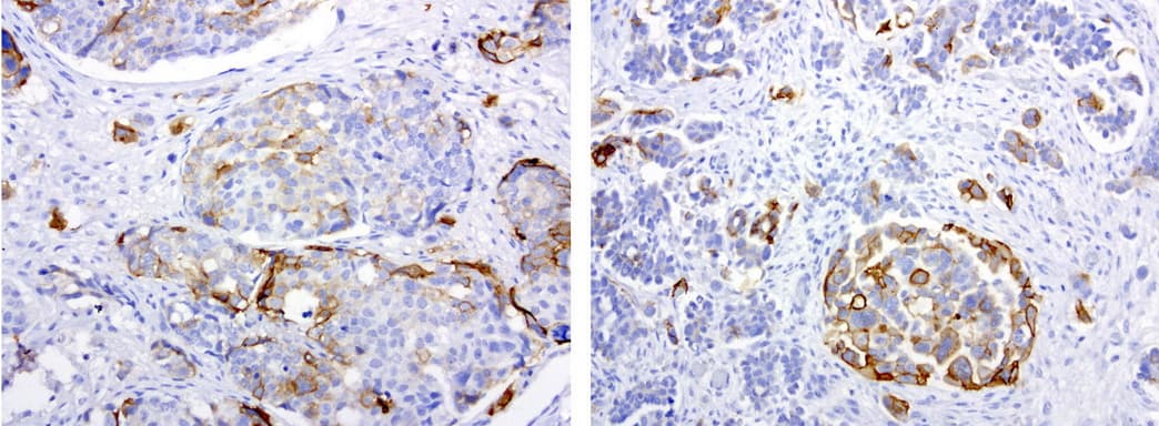 Monoclonal Mouse anti-Human L1CAM Antibody (clone UMAB48, IHC, IF, WB)