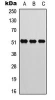 ATF2 Antibody (phospho-Thr73)